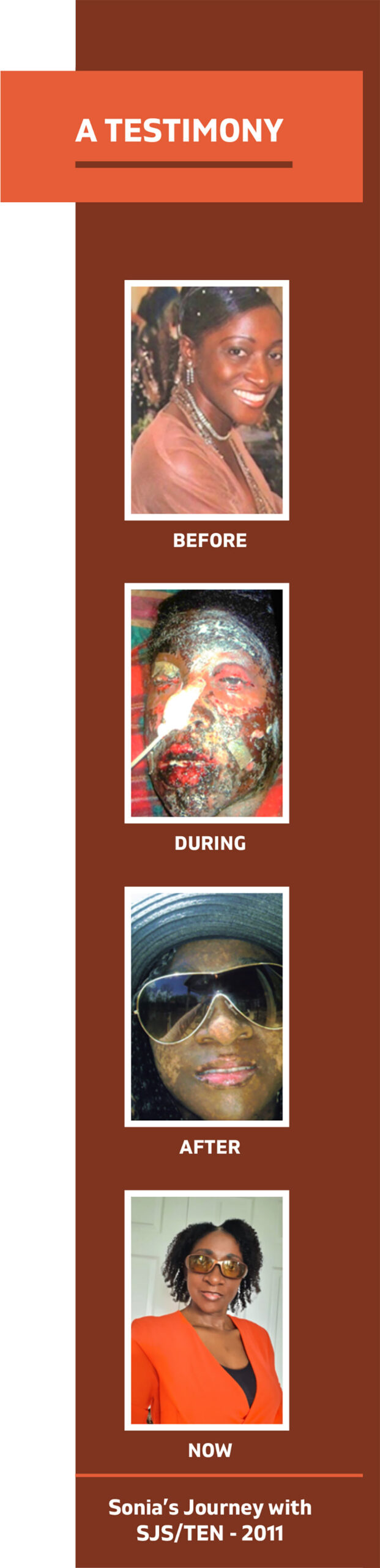 A Testimony; photos of Sonia's progress before, during, after, and now